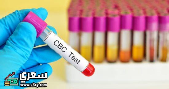 سعر تحليل cbc في مصر